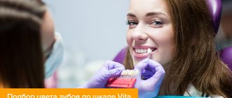 Фото девушки во время подбора цвета зубов по шкале Vita