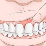 Гель стоматологический Холисал - отзывы