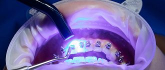 Главная картинка статьи Как стать стоматологом?