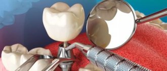 Имплантация зубов: новые технологии