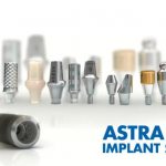 Импланты Астра Тек считаются одними из лучших зубных имплантов в мире