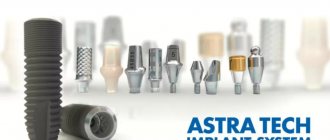 Импланты Астра Тек считаются одними из лучших зубных имплантов в мире