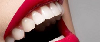 К чему видеть во сне белоснежные зубы
