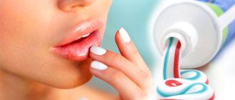 Как лечить герпес на губах зубной пастой