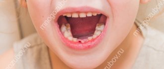Как остановить кровь при выбитом зубе у ребенка