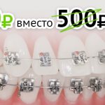 Ортодонтия зубов в Одинцово