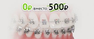Ортодонтия зубов в Одинцово