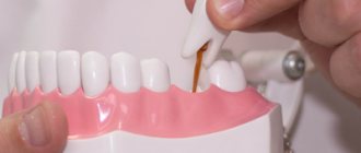 Ортопедическая стоматология - Стоматология Линия Улыбки