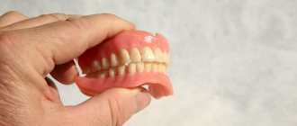 Почему болтается зубной протез и что можно предпринять