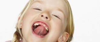 подрезание уздечки под языком у детей больно ли это