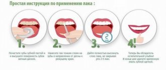применение эмали для зубов