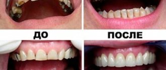 Примеры работ стоматологов клиники