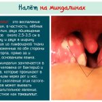 Привкус чеснока во рту. Причины, что означает симптом