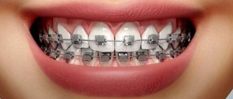 Продукция American Orthodontics