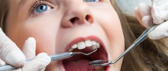 пульпотомия молочных зубов