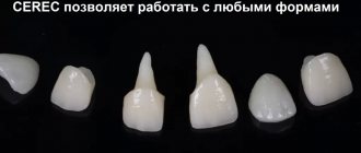 Различные формы зубов, сделанные по технологии CEREC
