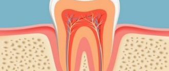 Секреты правильного лечения зубных каналов