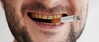 стоматологические заболевания от сигарет