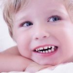 Тремы зубов у детей дошкольного возраста - естественный процесс роста и смены молочных зубов