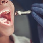 Заболевания эмали зубов