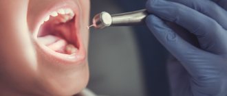 Заболевания эмали зубов